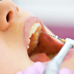Interesting Facts About Endodontics