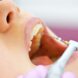 Interesting Facts About Endodontics
